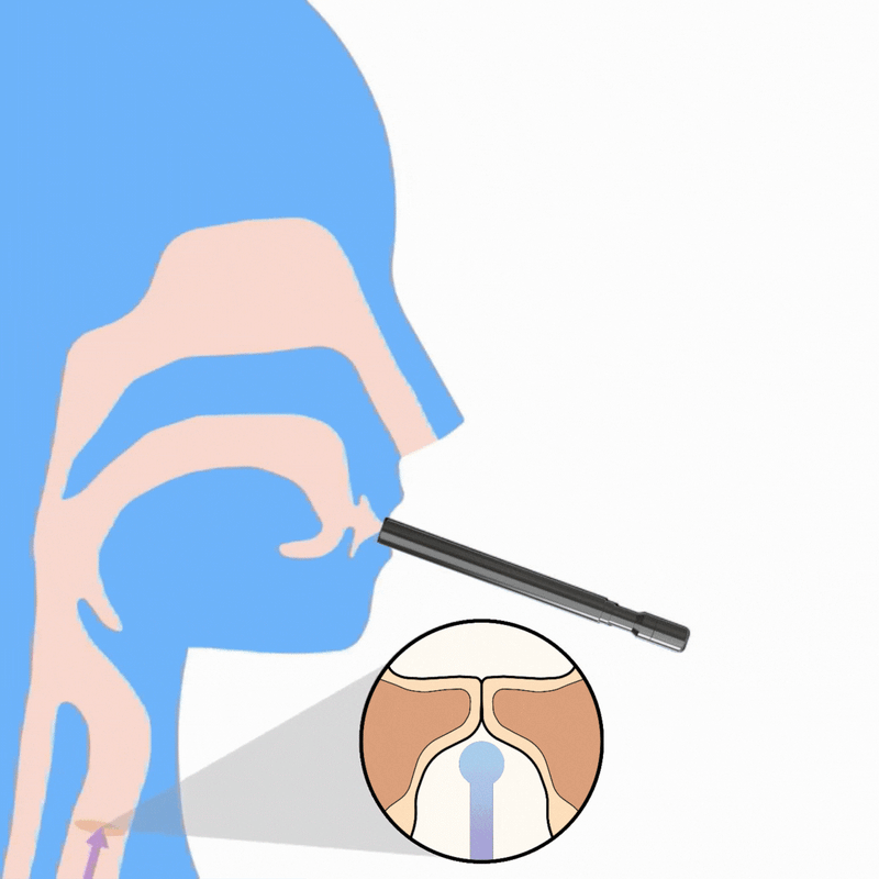 What does back-pressure do?